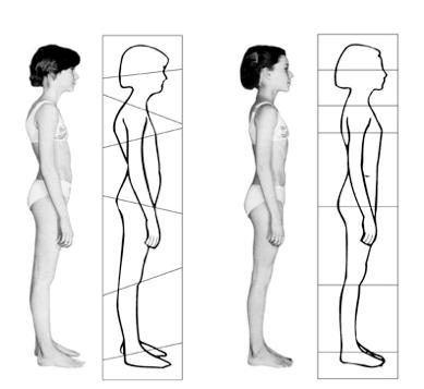 Rolfing – Strukturelle Integration – vor der ersten und nach der zehnten Sitzung 